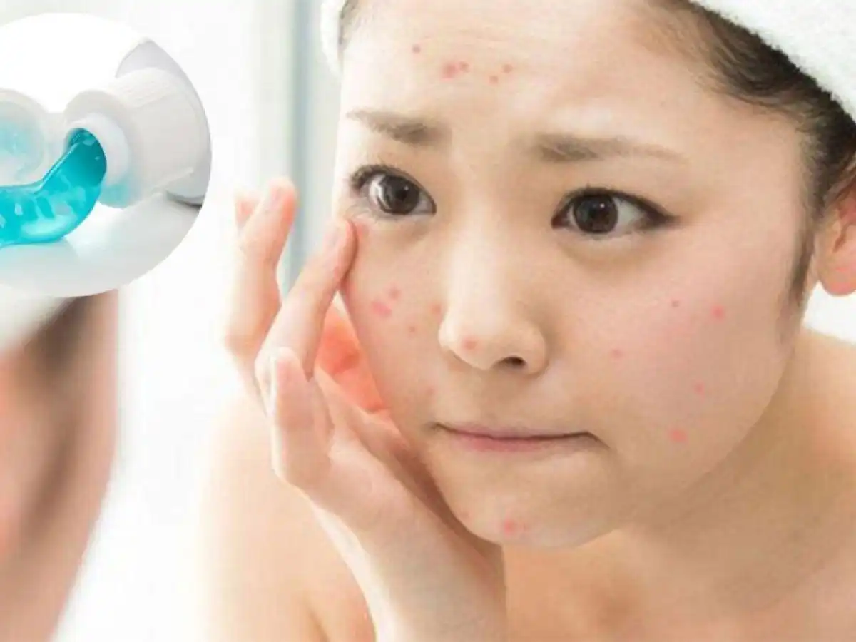 Bên cạnh những thành phần tốt, bạn cũng cần nhận diện những thành phần có khả năng gây hại cho làn da hỗn hợp Bên cạnh những thành phần tốt, bạn cũng cần nhận diện những thành phần có khả năng gây hại cho làn da hỗn hợp