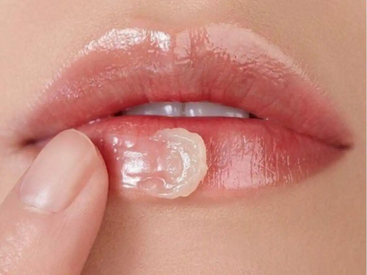 Bị dị ứng son môi nên bôi thuốc gì?