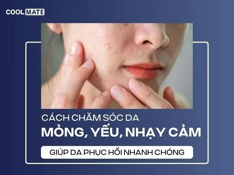 Cách chăm sóc da mỏng yếu hiệu quả và an toàn