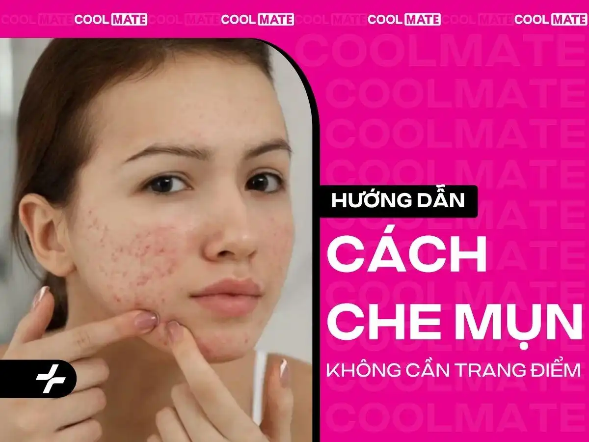 Cách Che Mụn Bằng Makeup Hiệu Quả & Nhanh Gọn