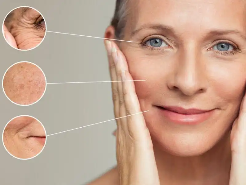Càng lớn tuổi thì quá trình sản xuất collagen và elastin trong da giảm dần khiến da trở nên mỏng hơn Càng lớn tuổi thì quá trình sản xuất collagen và elastin trong da giảm dần khiến da trở nên mỏng hơn