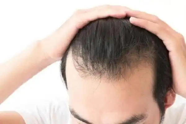 Dầu gội mọc tóc cho nam: 18 sản phẩm hiệu quả nhất