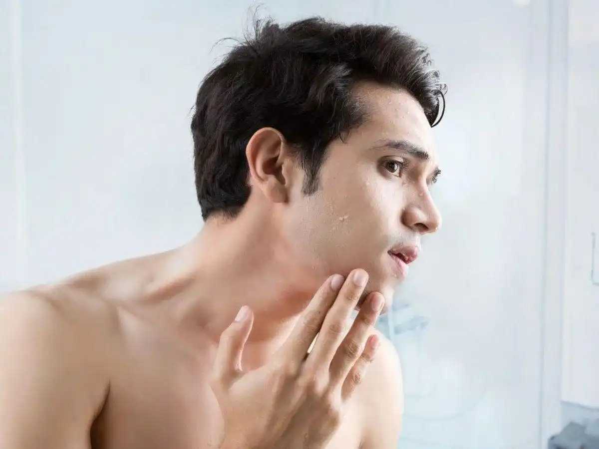 Làn da nam giới dễ bị kích ứng nếu không chăm sóc kỹ