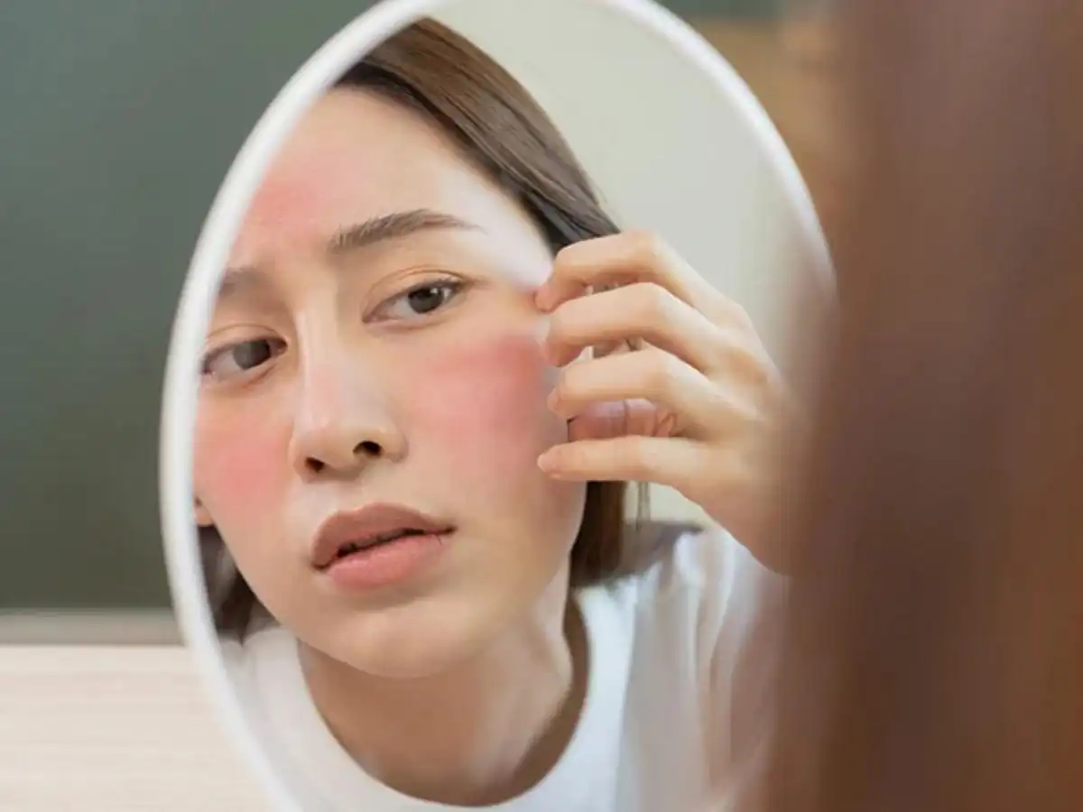 Làn da nhạy cảm cần được bảo vệ cẩn thận