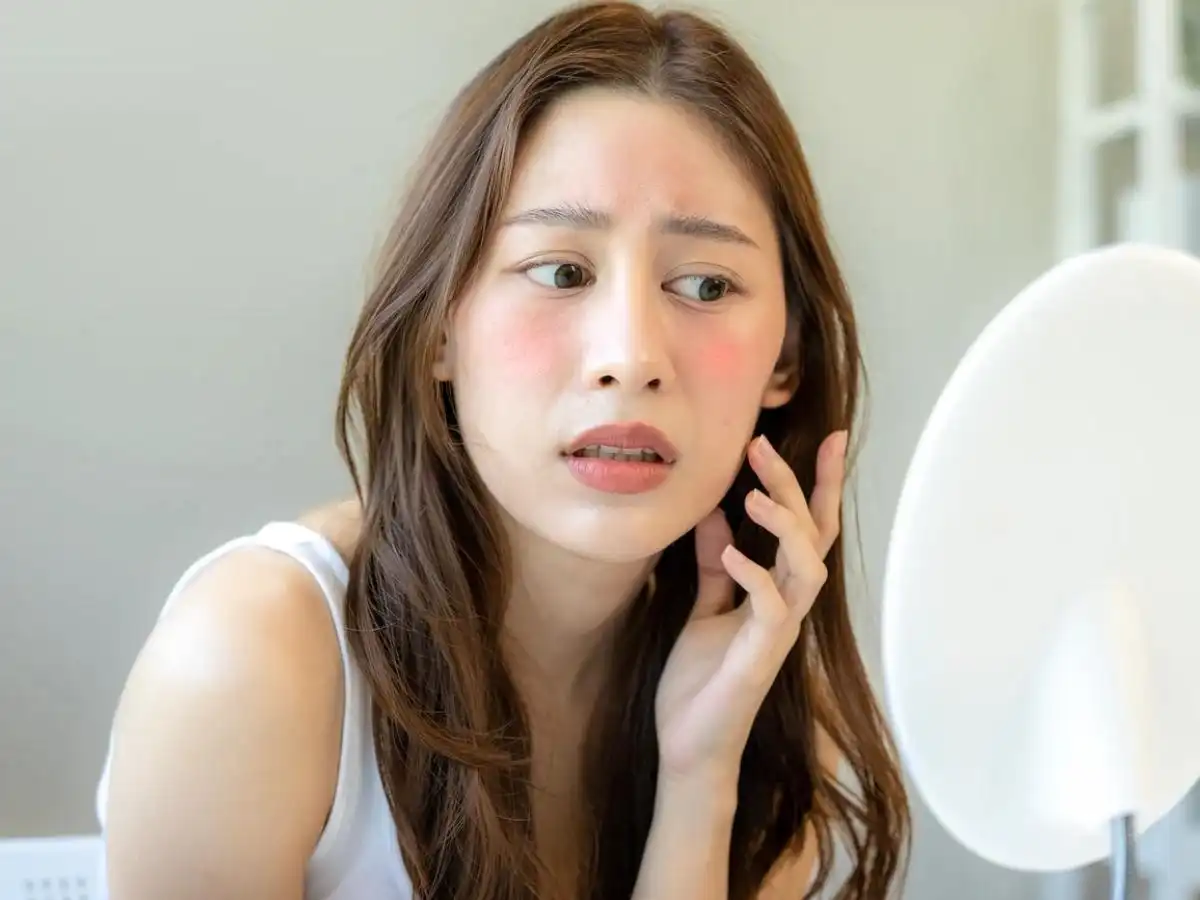 Làn da nhạy cảm cần lựa chọn sữa rửa mặt phù hợp Làn da nhạy cảm cần lựa chọn sữa rửa mặt phù hợp