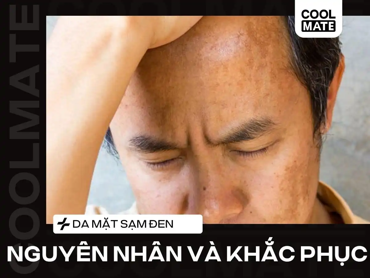 Nguyên Nhân Làn Da Sạm Đen Ở Nam Giới Và Cách Khắc Phục Hiệu Quả