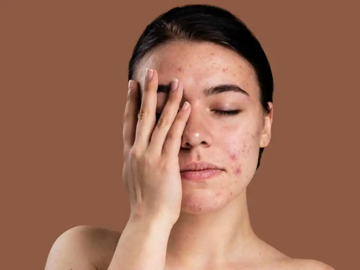 Nguyên nhân và dấu hiệu của làn da nhạy cảm Nguyên nhân và dấu hiệu của làn da nhạy cảm