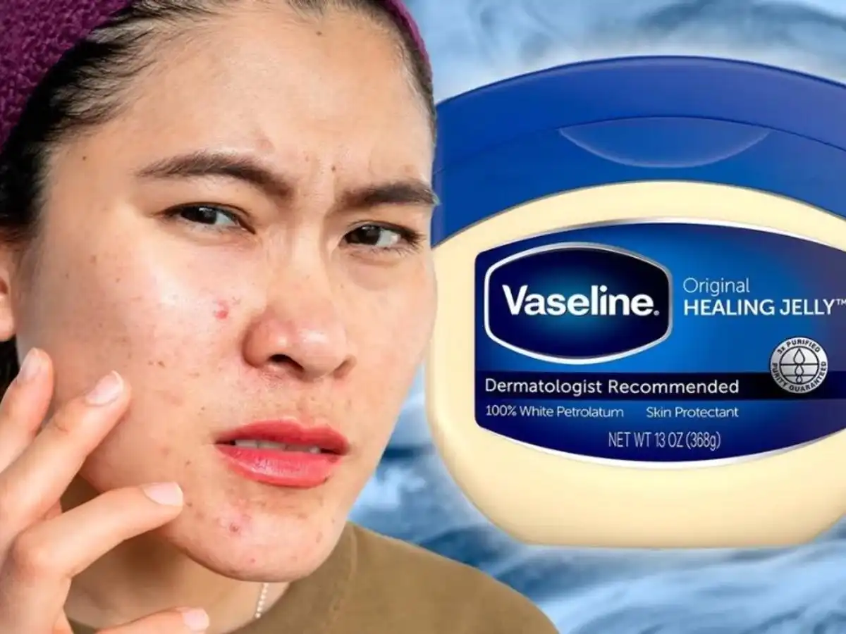 Nhược điểm khi thực hiện tẩy trang bằng Vaseline