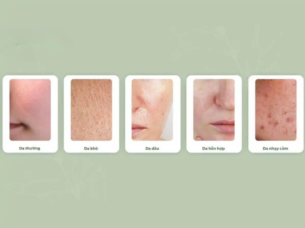 Phân biệt 5 loại da nam giới Phân biệt 5 loại da nam giới