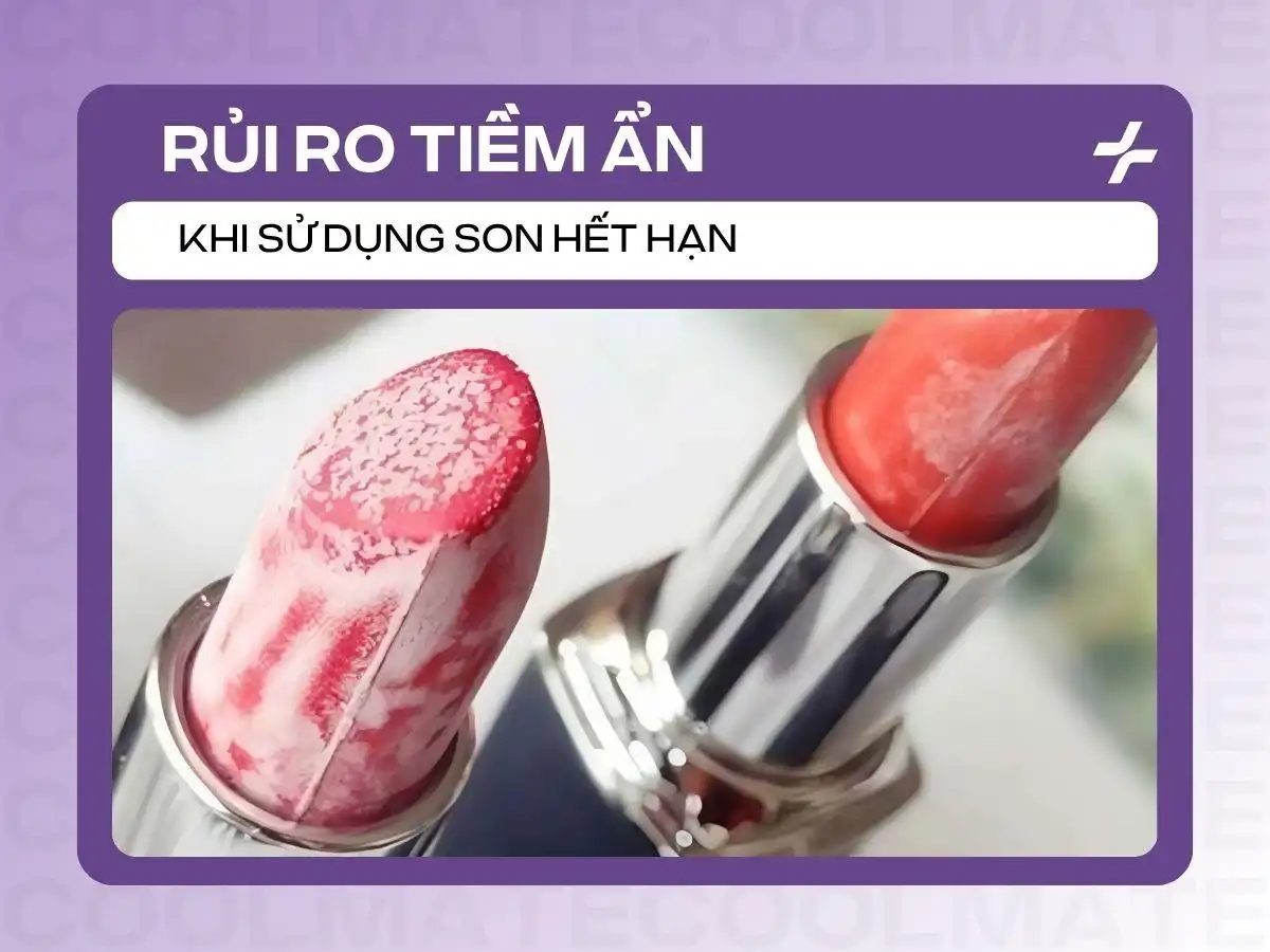 Son hết hạn có dùng được không: Rủi ro và dấu hiệu nhận biết