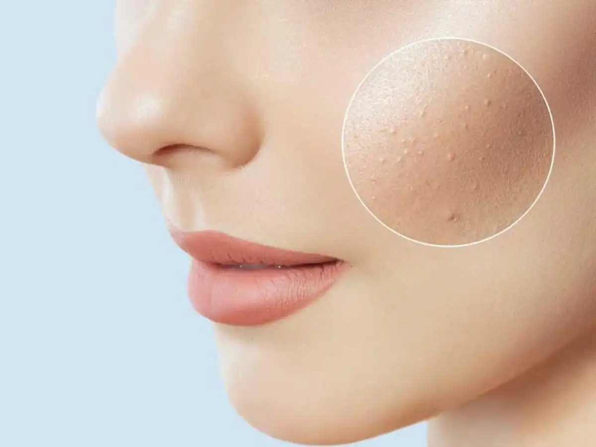 Sự có mặt của các thành phần trị mụn, làm dịu này sẽ là điểm cộng lớn cho sữa rửa mặt