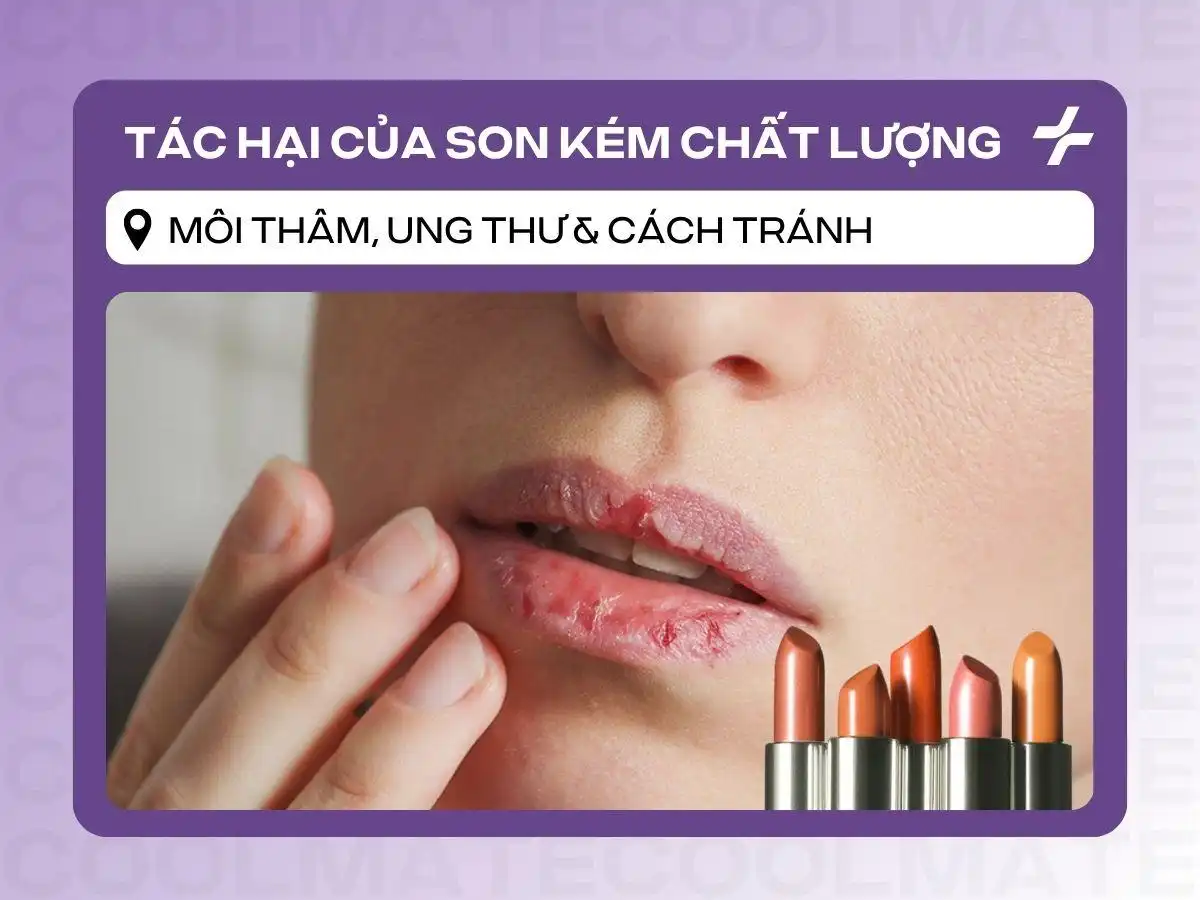 Tác hại son kém chất lượng: Môi thâm, ung thư và cách tránh hiệu quả