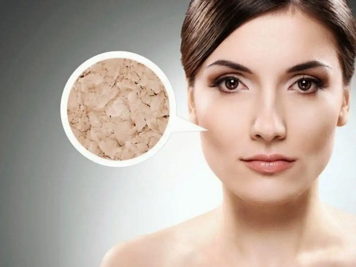 Thiếu bước skincare da có thể bị thiếu độ ẩm, khiến lớp trang điểm không đều Thiếu bước skincare da có thể bị thiếu độ ẩm, khiến lớp trang điểm không đều