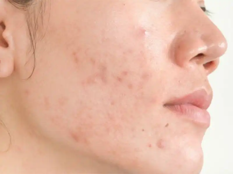Tránh xa các tác nhân dễ dàng gây kích ứng cho làn da Tránh xa các tác nhân dễ dàng gây kích ứng cho làn da