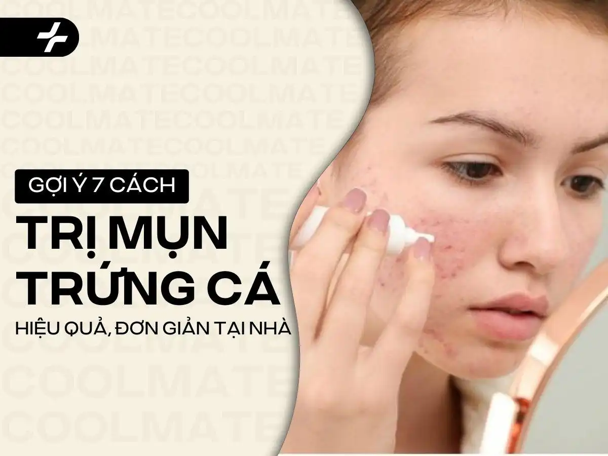 Trị Mụn Trứng Cá Tại Nhà: 7 Cách Hiệu Quả & Routine Chăm Da