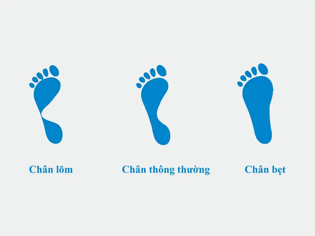 Xác định dáng bàn chân